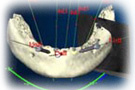 imp_step3