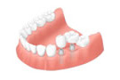 imp_step8